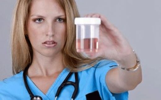 Çocuklarda İdrarda Kan Belirtileri ve Tedavisi