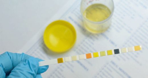 Gebelikte İdrarda Lökosit Yüksekliği Nedenleri?