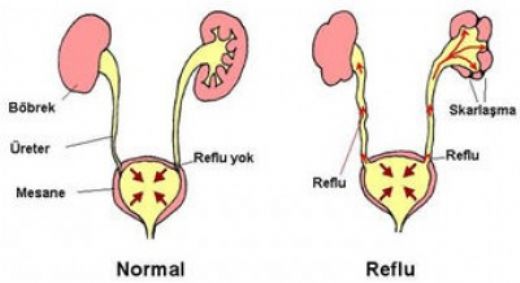 İdrar Kesesi Görevi Nelerdir?