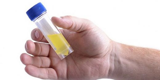 İdrar Neden Köpürür?