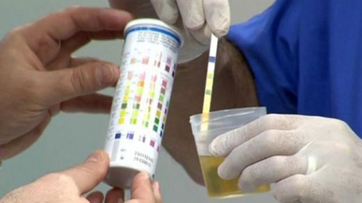 İdrar Stribi Değerleri