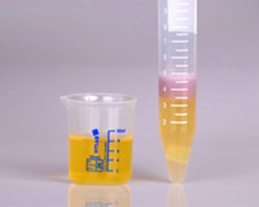 İdrarda Dansite Oranı