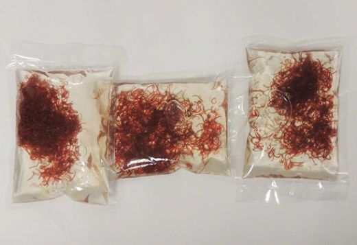 İdrarda Kan Pıhtısı Belirtileri ve Tedavisi