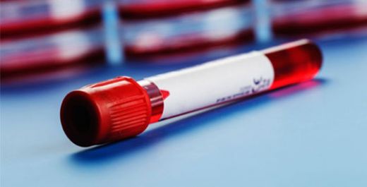 İdrarda Kreatinin Değeri