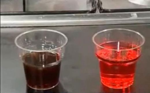 Kahverengi İdrar Belirtileri ve Tedavisi