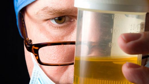 Kokulu İdrar Tedavisi