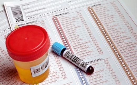 Tam İdrar Tahlili Nasıl Yapılır?